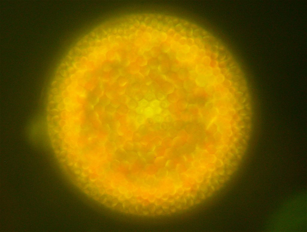 Centric diatom