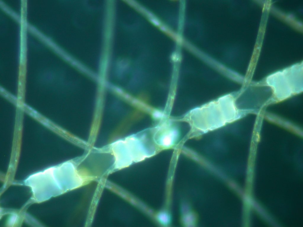 Chaetoceros, a chain-forming diatom