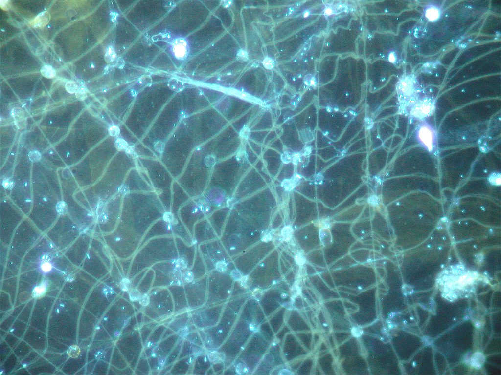 Larvacean web